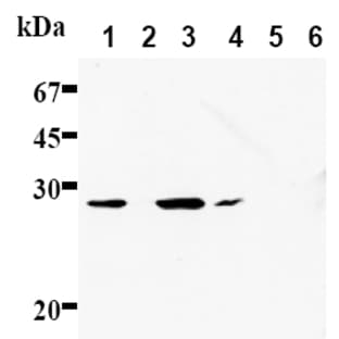 anti-B-Cell CLL/lymphoma 2 (BCL2) (AA 61-76) antibody avatar
