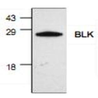 anti-B Lymphoid Tyrosine Kinase (BLK) antibody avatar
