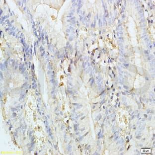 anti-Chymase 1, Mast Cell (CMA1) antibody avatar