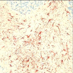 anti-Complement Component 5a Receptor 1 (C5AR1) (C-Term) antibody avatar