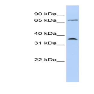 anti-Chemokine (C-C Motif) Receptor 4 (CCR4) (Middle Region) antibody avatar