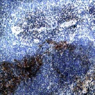 anti-Chemokine (C-C Motif) Receptor 7 (CCR7) (AA 2-22) antibody avatar