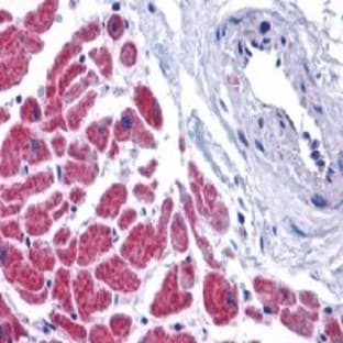 anti-Caspase 12 (CASP12) (N-Term) antibody