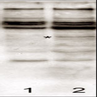 anti-Caspase 2, Apoptosis-Related Cysteine Peptidase (CASP2) (N-Term) antibody avatar