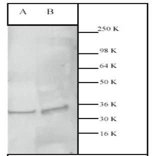 anti-Caspase 3, Apoptosis-Related Cysteine Peptidase (CASP3) (N-Term) antibody avatar