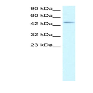 anti-Chemokine (C-C Motif) Receptor 8 (CCR8) (Middle Region) antibody avatar