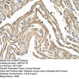 anti-Chemokine Binding Protein 2 (CCBP2) (N-Term) antibody avatar