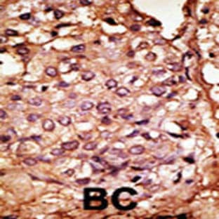 anti-Chemokine Binding Protein 2 (CCBP2) (N-Term), (AA 54-84) antibody avatar