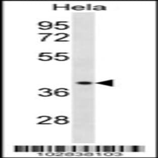 anti-Chemokine Binding Protein 2 (CCBP2) (C-Term), (AA 298-328) antibody avatar