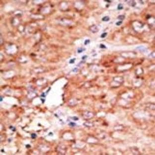 anti-Chemokine Binding Protein 2 (CCBP2) (C-Term) antibody avatar