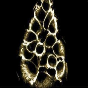 anti-Catenin, beta (AA 571-781) antibody avatar