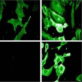 anti-Catenin (Cadherin-Associated Protein), delta 1 (CTNND1) (pTyr228) antibody avatar