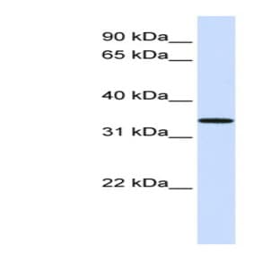anti-Chromosome 16 Open Reading Frame 78 (C16orf78) (Middle Region) antibody avatar