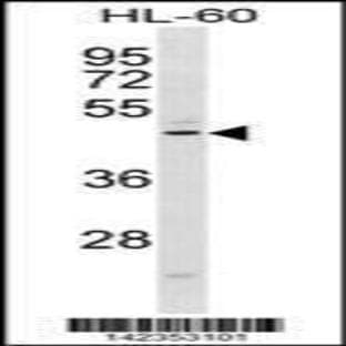 anti-Chemokine-Like Receptor 1 (CMKLR1) (C-Term), (AA 305-333) antibody avatar