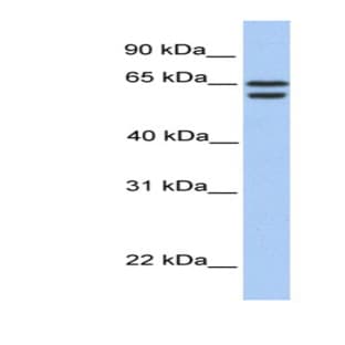 anti-Chromodomain Protein, Y-Like 2 (CDYL2) (N-Term) antibody avatar