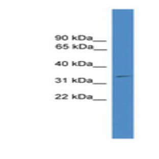 anti-Cyclin D1 (CCND1) (C-Term) antibody avatar