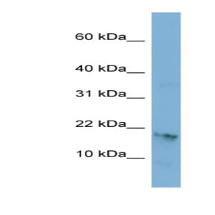 anti-Chromosome 17 Open Reading Frame 64 (C17orf64) (Middle Region) antibody avatar