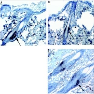 anti-CD34 Molecule (CD34) antibody avatar