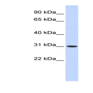 anti-Cytochrome B5 Domain Containing 2 (CYB5D2) (N-Term) antibody avatar