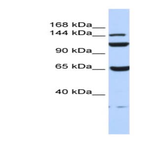 anti-Chromosome 17 Open Reading Frame 57 (C17orf57) (N-Term) antibody avatar