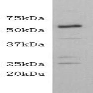 anti-CD4 Molecule (CD4) antibody avatar
