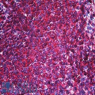 anti-CD44 (CD44) antibody avatar