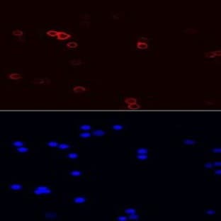 anti-CD44 (CD44) antibody avatar