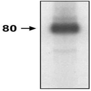 anti-CD44 (CD44) antibody avatar