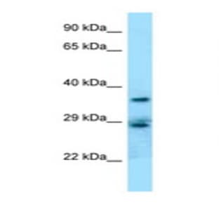 anti-CD68 Molecule (CD68) (Internal Region) antibody avatar