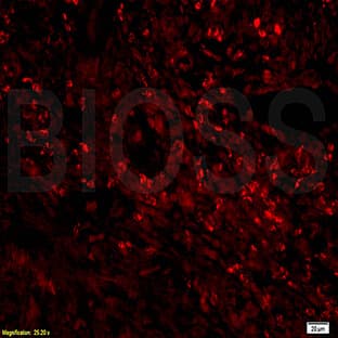 anti-CD68 Molecule (CD68) antibody avatar