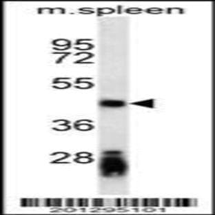 anti-CD79a Molecule, Immunoglobulin-Associated alpha (CD79A) antibody avatar