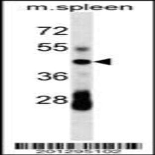 anti-CD79a Molecule, Immunoglobulin-Associated alpha (CD79A) (C-Term), (AA 160-188) antibody avatar