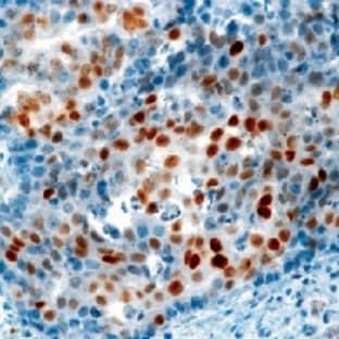 anti-Cyclin-Dependent Kinase Inhibitor 1A (p21, Cip1) (CDKN1A) antibody avatar