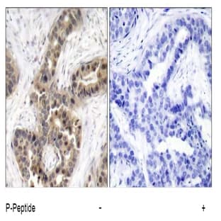 anti-Cyclin-Dependent Kinase Inhibitor 1A (p21, Cip1) (CDKN1A) (pThr145) antibody avatar