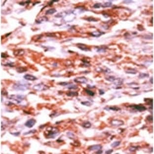 anti-Cyclin-Dependent Kinase Inhibitor 1A (p21, Cip1) (CDKN1A) (pSer130) antibody avatar