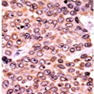 anti-Cyclin-Dependent Kinase Inhibitor 1A (p21, Cip1) (CDKN1A) (pThr145) antibody avatar