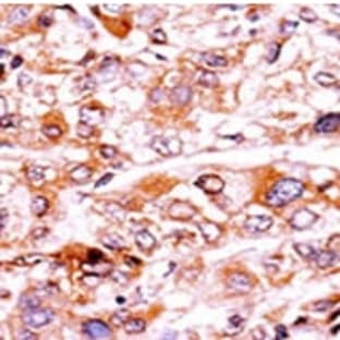 anti-Cyclin-Dependent Kinase Inhibitor 1A (p21, Cip1) (CDKN1A) (pThr57) antibody avatar