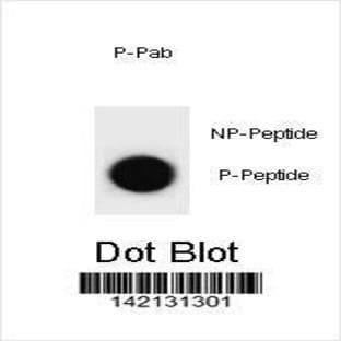 anti-Cyclin-Dependent Kinase Inhibitor 1B (p27, Kip1) (CDKN1B) (pThr197) antibody avatar