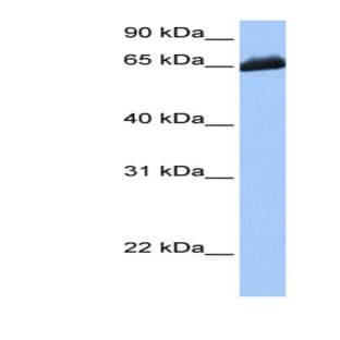 anti-Chromosome 19 Open Reading Frame 21 (C19orf21) (C-Term) antibody avatar