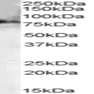 anti-Choline O-Acetyltransferase (CHAT) (C-Term) antibody avatar