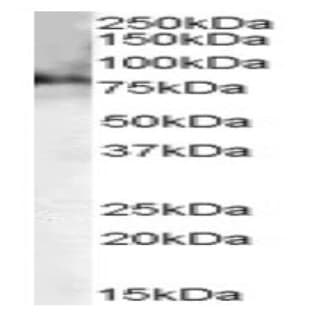 anti-Choline O-Acetyltransferase (CHAT) (C-Term) antibody avatar