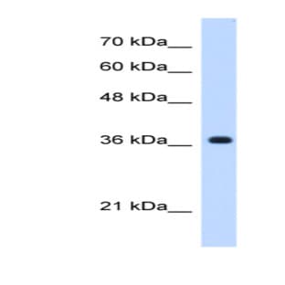 anti-Chromosome 19 Open Reading Frame 47 (C19orf47) (C-Term) antibody avatar