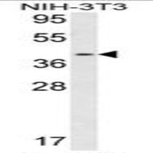anti-Calponin 3, Acidic (CNN3) (Middle Region) antibody avatar