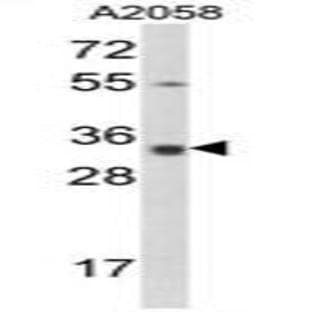 anti-Calponin 3, Acidic (CNN3) (N-Term) antibody avatar