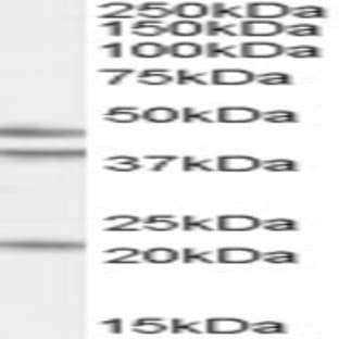 anti-GA-Binding Protein Subunit beta-2 (GABPB2) (Internal Region) antibody avatar
