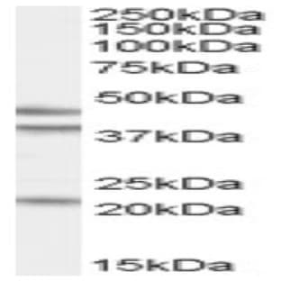 anti-GA-Binding Protein Subunit beta-2 (GABPB2) (Internal Region) antibody avatar