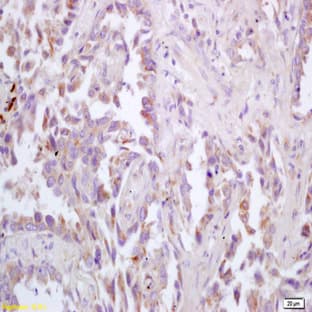 anti-Cholinergic Receptor, Muscarinic 3 (CHRM3) antibody avatar