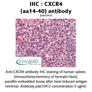 anti-Chemokine (C-X-C Motif) Receptor 4 (CXCR4) (N-Term), (Extracellular Domain), (AA 14-40) antibody avatar