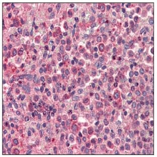 anti-Chemokine (C-X-C Motif) Receptor 4 (CXCR4) (N-Term), (Extracellular Domain), (AA 14-40) antibody avatar