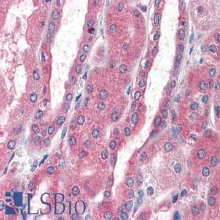 anti-Chemokine (C-X-C Motif) Receptor 4 (CXCR4) (AA 14-40) antibody avatar